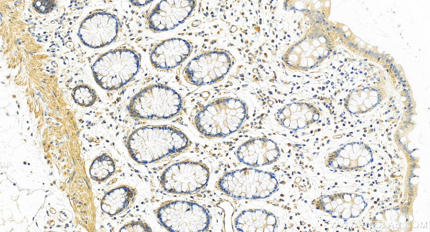 IHC staining of human colon using 15854-1-AP