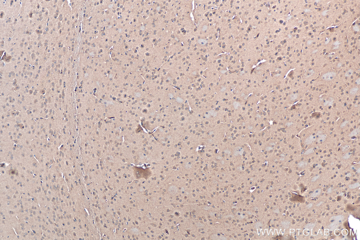 IHC staining of mouse brain using 21638-1-AP