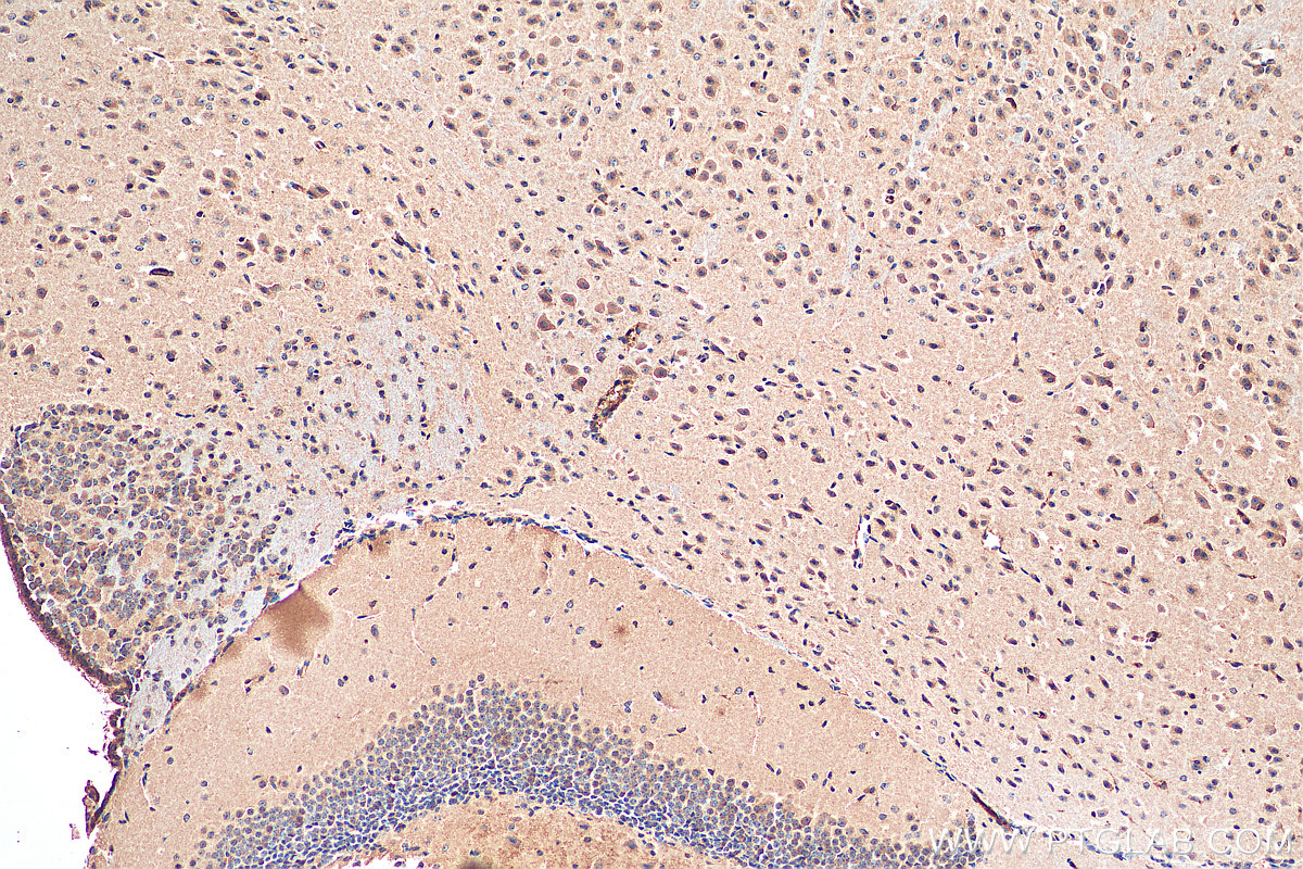 IHC staining of mouse brain using 67926-1-Ig (same clone as 67926-1-PBS)