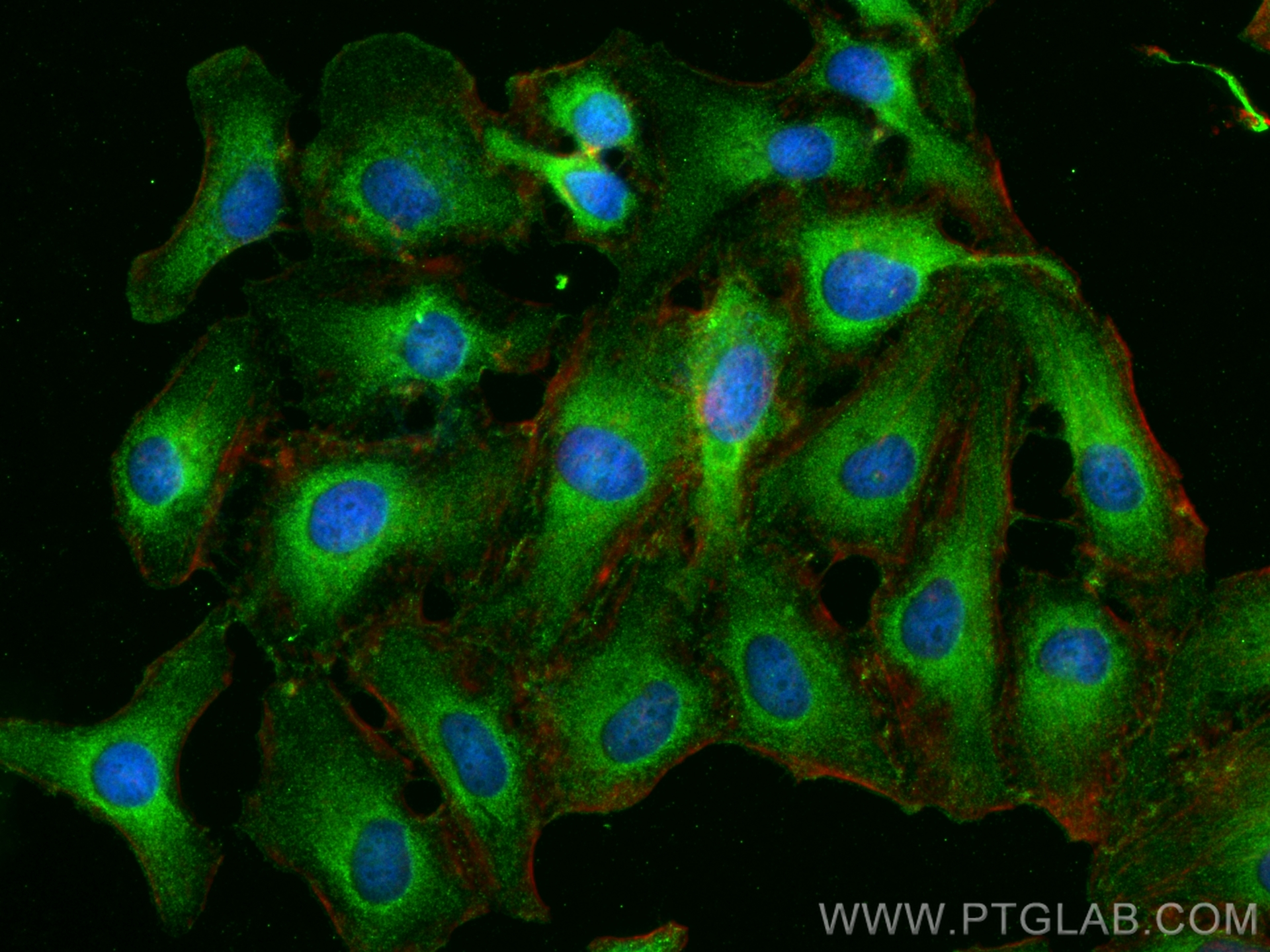 IF Staining of HeLa using 21079-1-AP