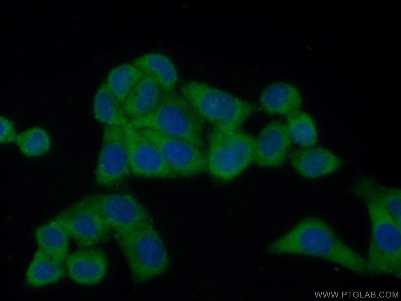 IF Staining of HepG2 using 21529-1-AP