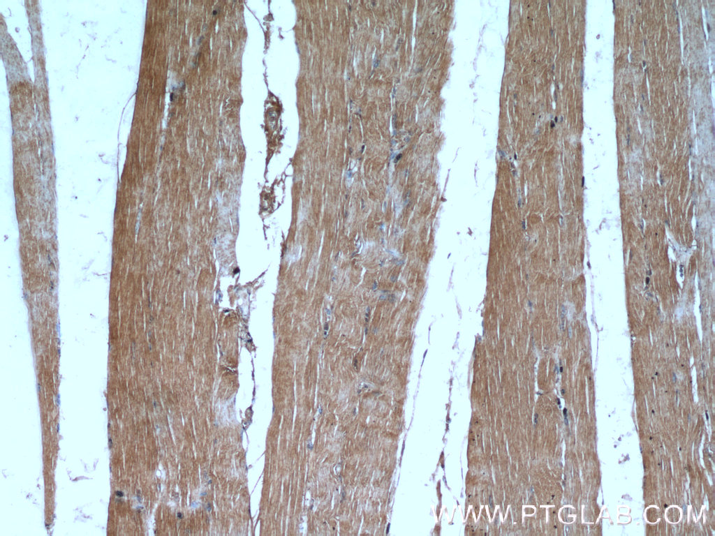 IHC staining of human skeletal muscle using 21529-1-AP