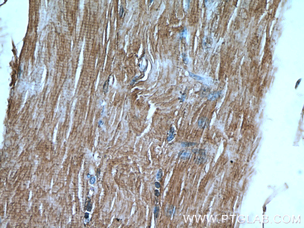 IHC staining of human skeletal muscle using 21529-1-AP