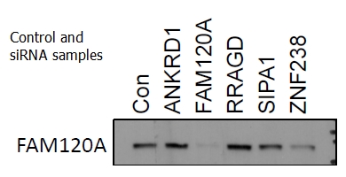 WB analysis of siRNA cells using 21529-1-AP