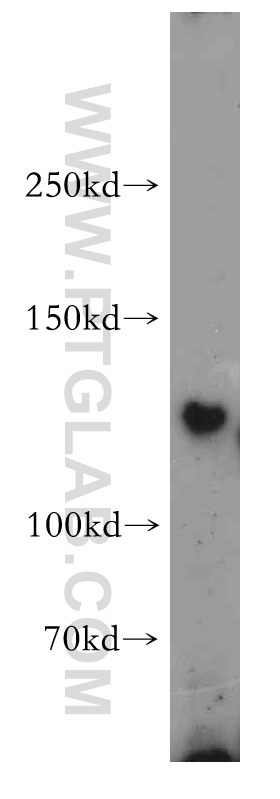 WB analysis of HEK-293 using 21529-1-AP