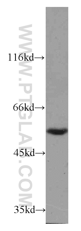 WB analysis of K-562 using 21313-1-AP