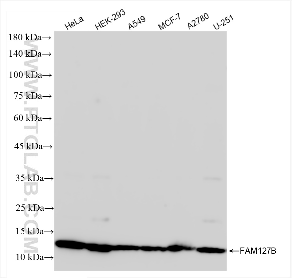 WB analysis using 83862-1-RR (same clone as 83862-1-PBS)