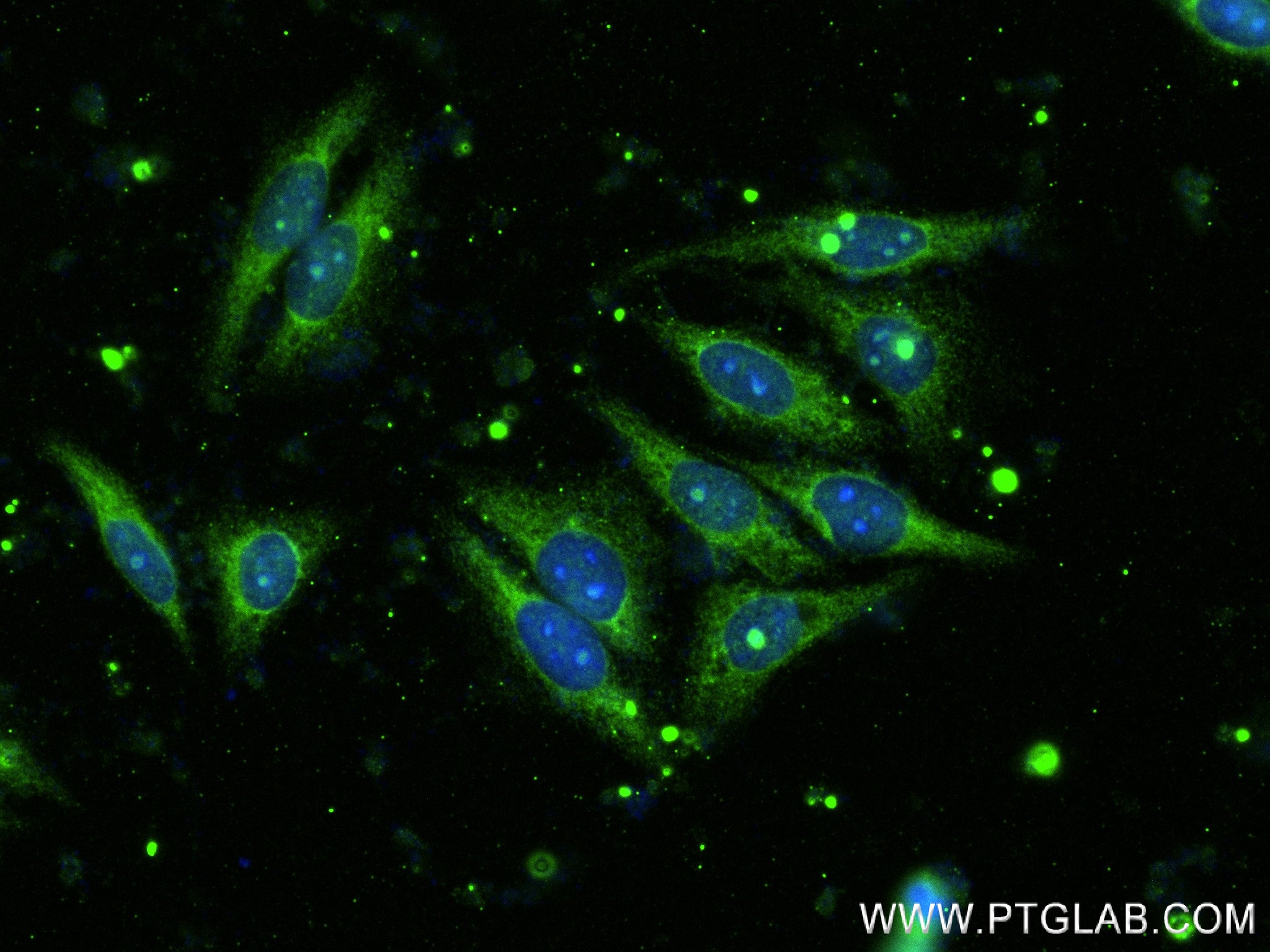 IF Staining of HepG2 using 83862-2-RR (same clone as 83862-2-PBS)