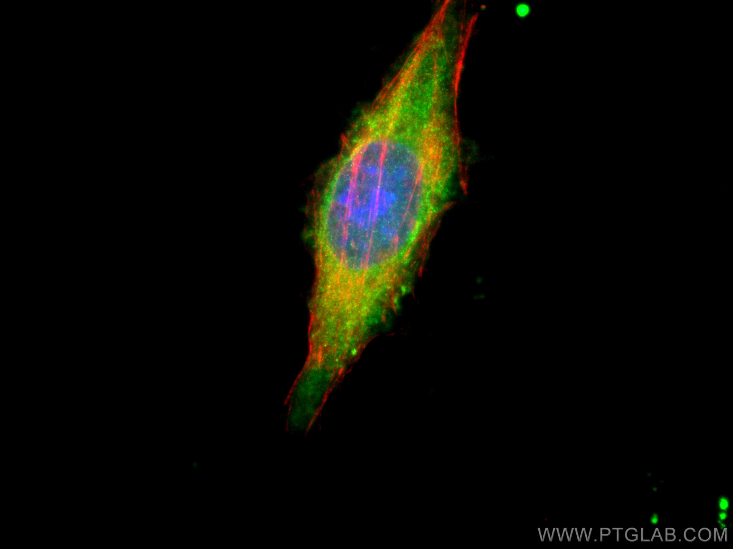 IF Staining of HepG2 using 21333-1-AP