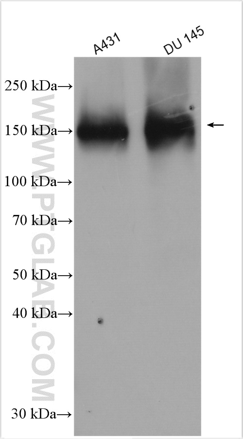 WB analysis using 21333-1-AP