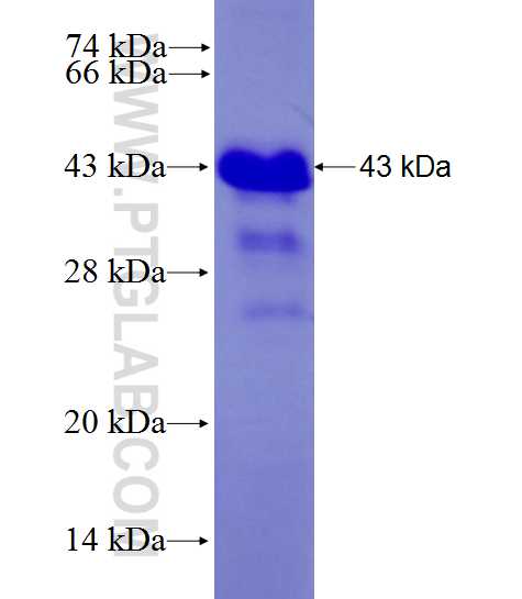 FAM135B fusion protein Ag27904 SDS-PAGE