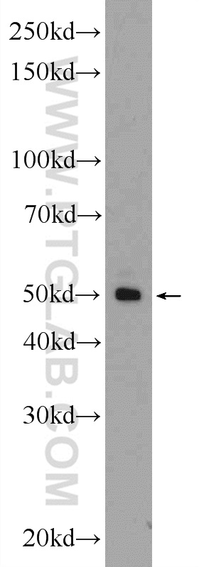 WB analysis of K-562 using 24929-1-AP