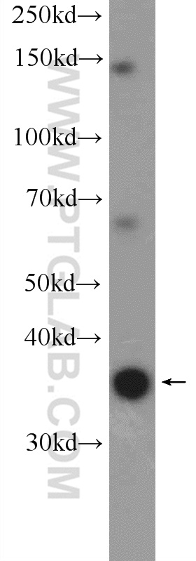 WB analysis of HeLa using 20520-1-AP