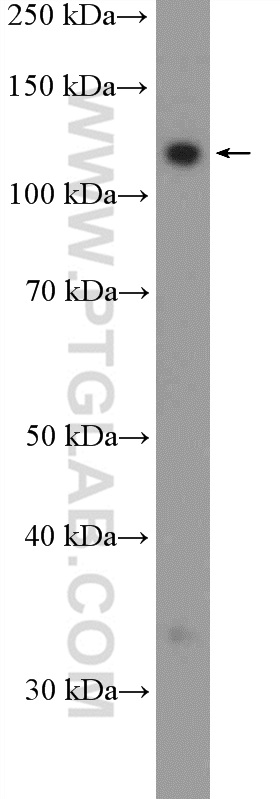 WB analysis of HeLa using 21022-1-AP