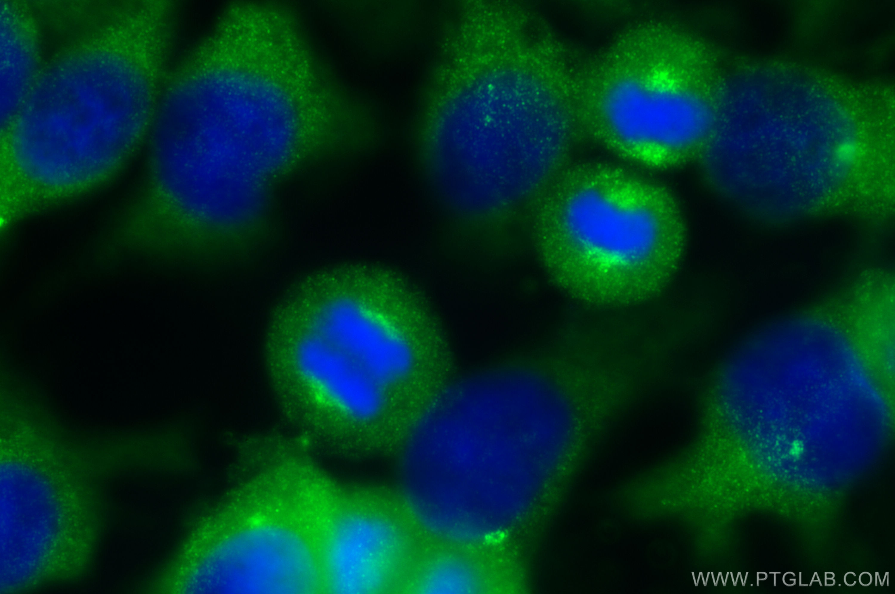 IF Staining of HeLa using 16933-1-AP