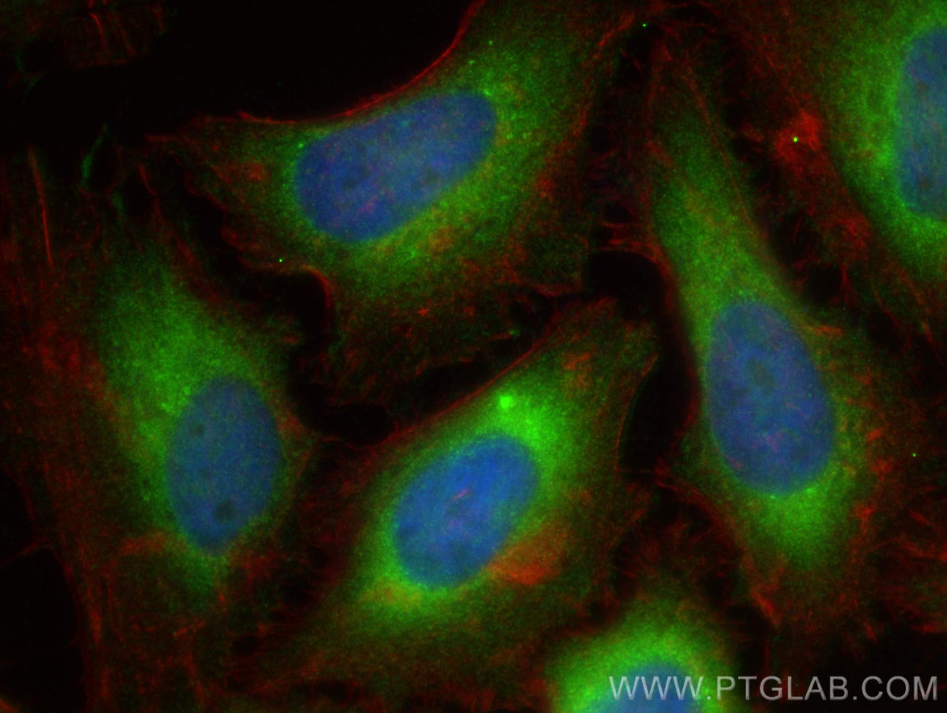 IF Staining of HeLa using 25752-1-AP