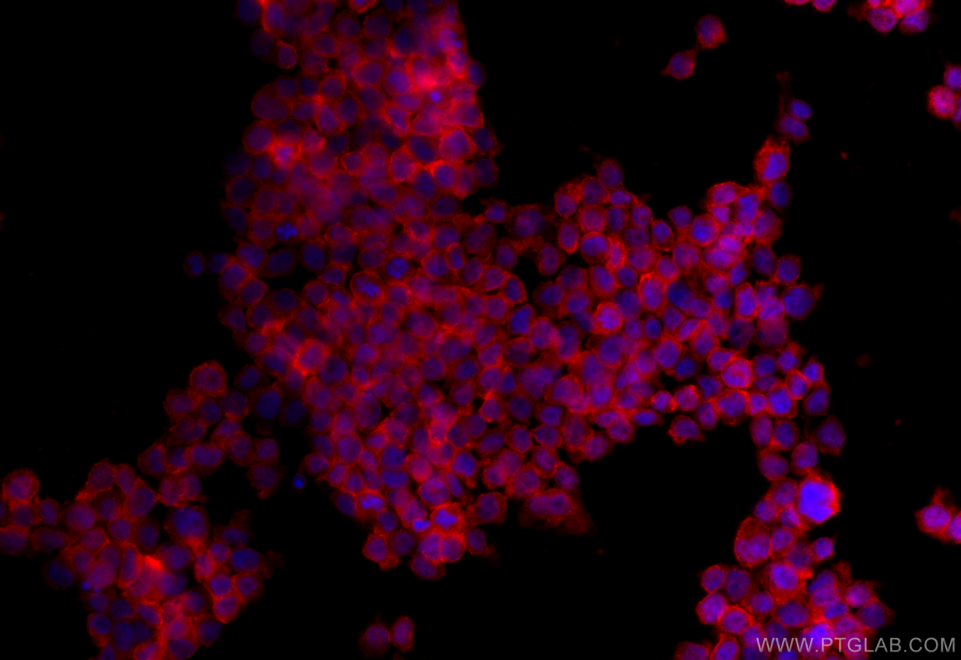 IF Staining of THP-1 using 15939-1-AP