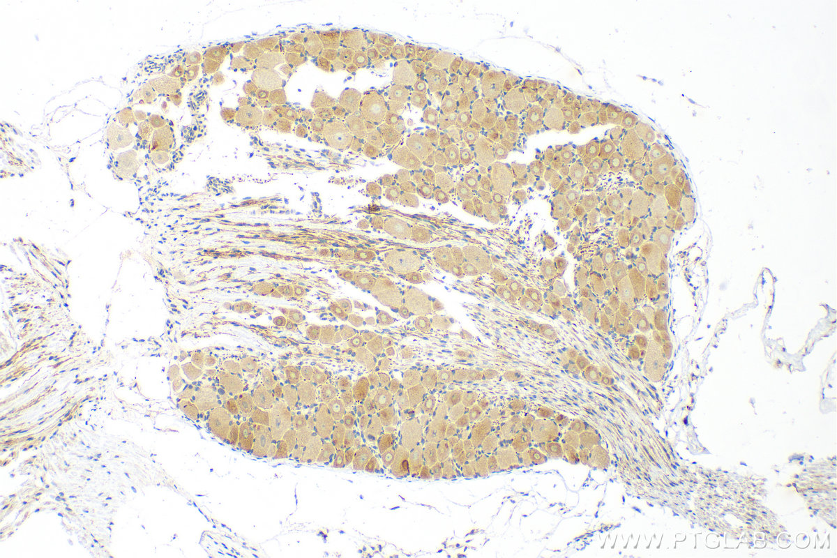 IHC staining of rat dorsal root ganglion using 82625-4-RR (same clone as 82625-4-PBS)