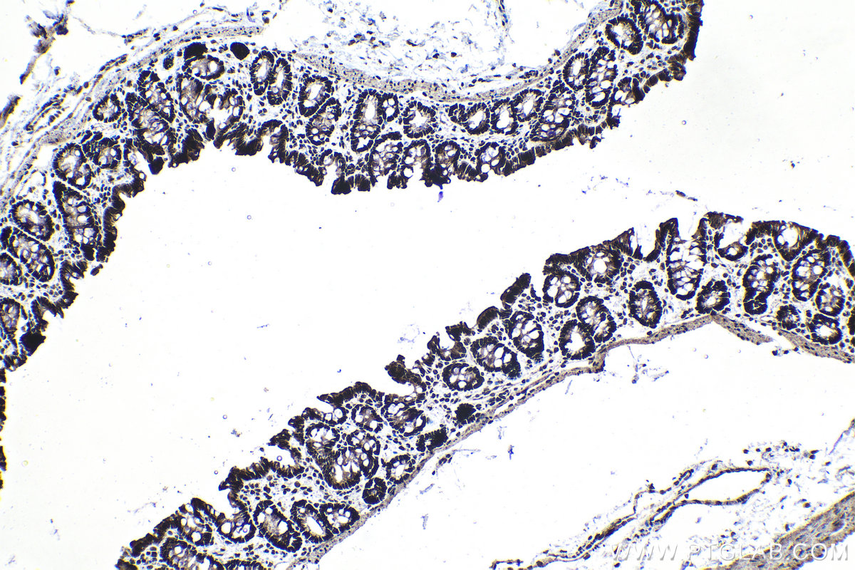 IHC staining of rat colon using 19849-1-AP