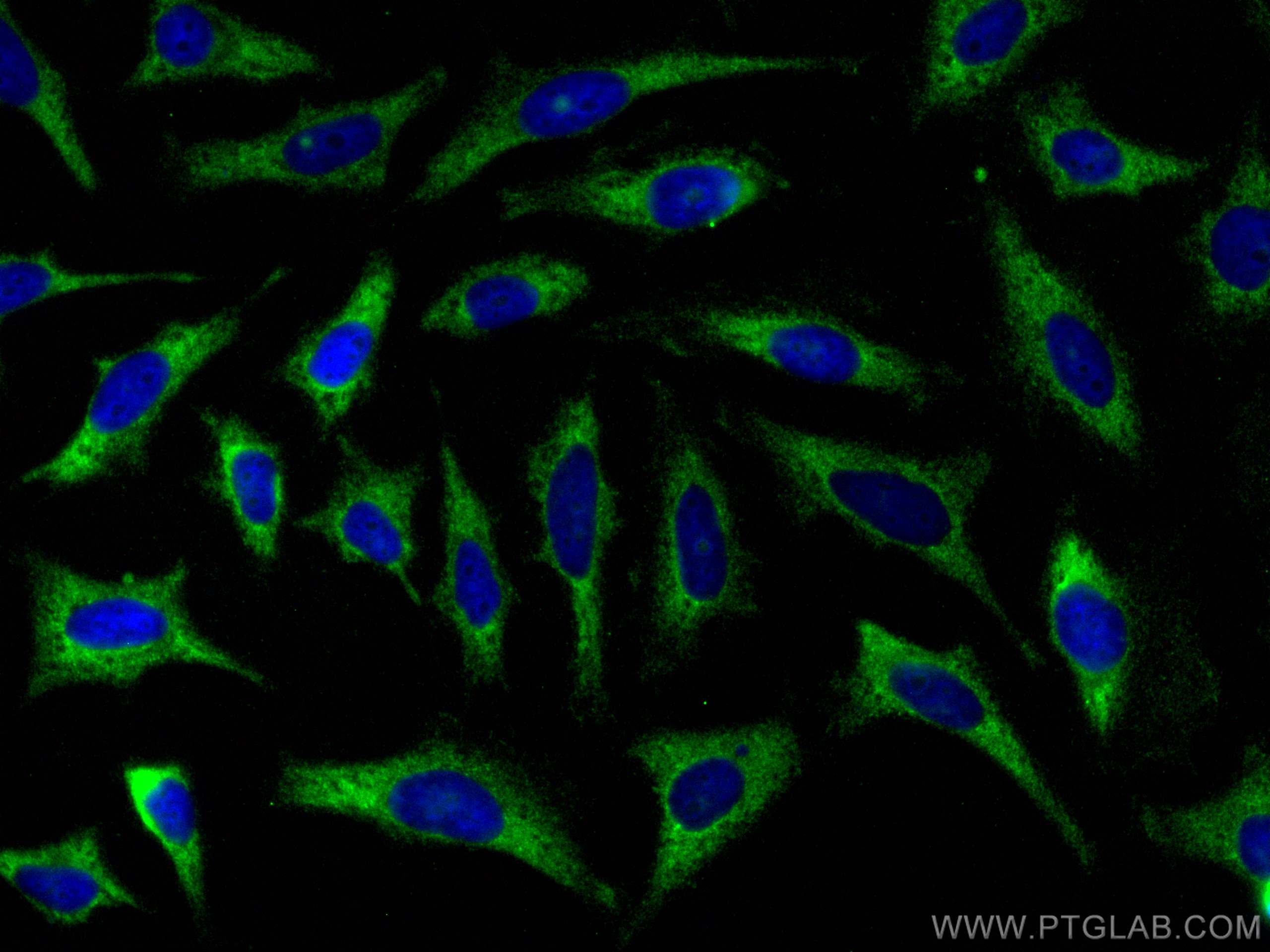 IF Staining of HeLa using 26569-1-AP