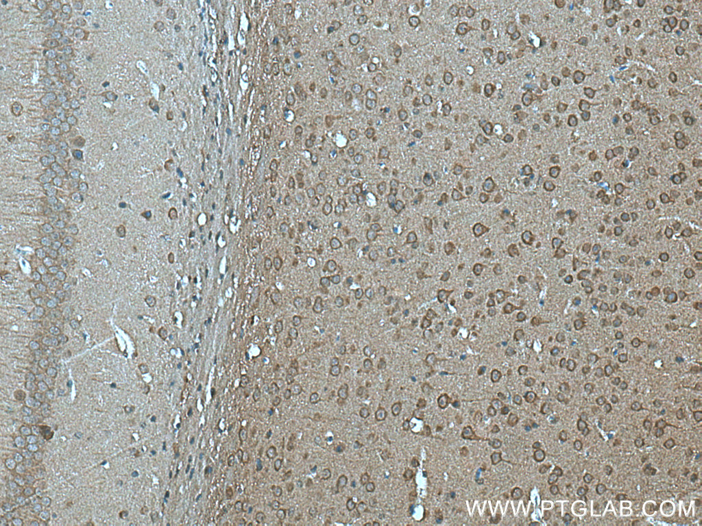 IHC staining of mouse brain using 20760-1-AP