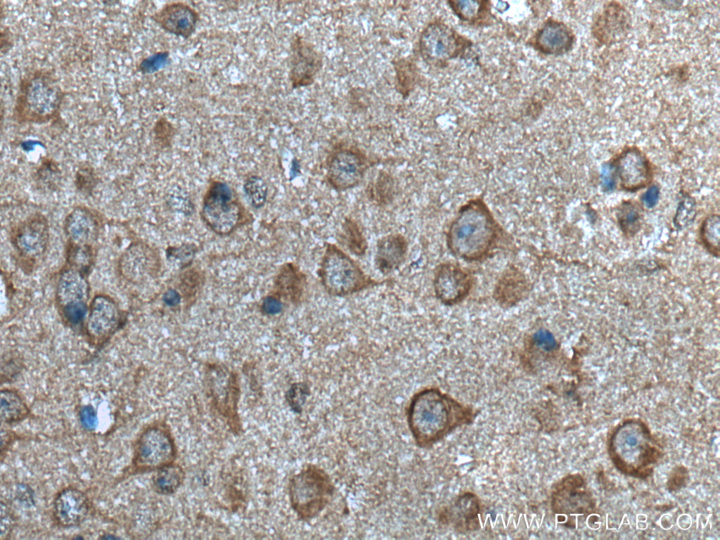 IHC staining of mouse brain using 20760-1-AP