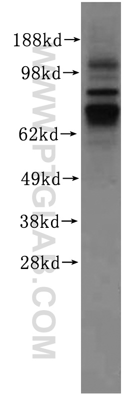 WB analysis of human skeletal muscle using 17015-1-AP