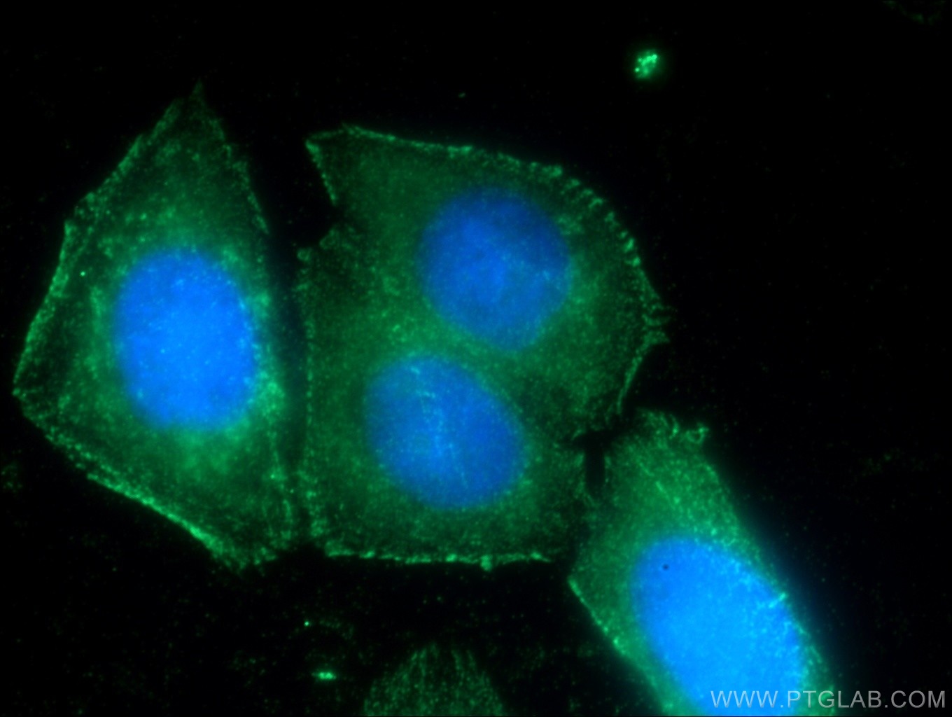 IF Staining of HepG2 using 21038-1-AP