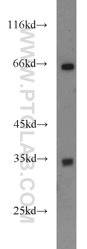 WB analysis of mouse liver using 21038-1-AP