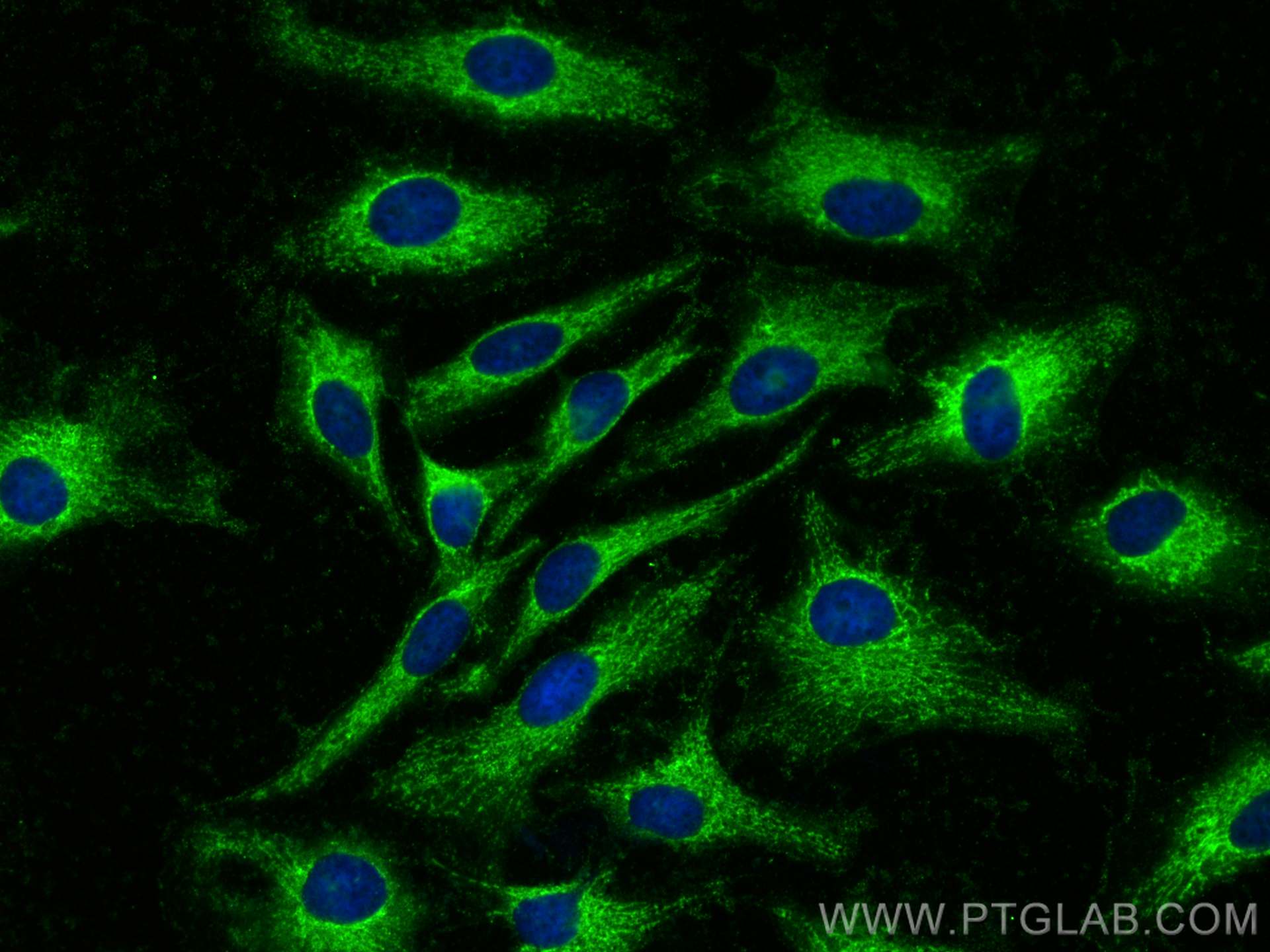 IF Staining of HeLa using 24803-1-AP