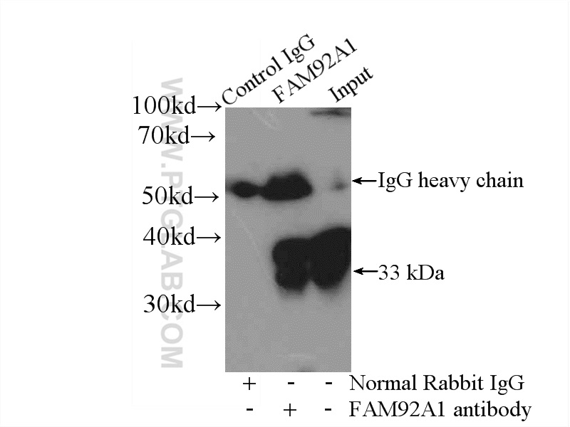 IP experiment of HeLa using 24803-1-AP