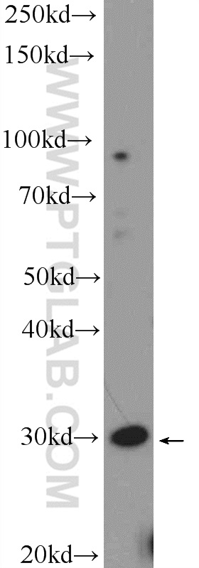 WB analysis of HeLa using 24803-1-AP