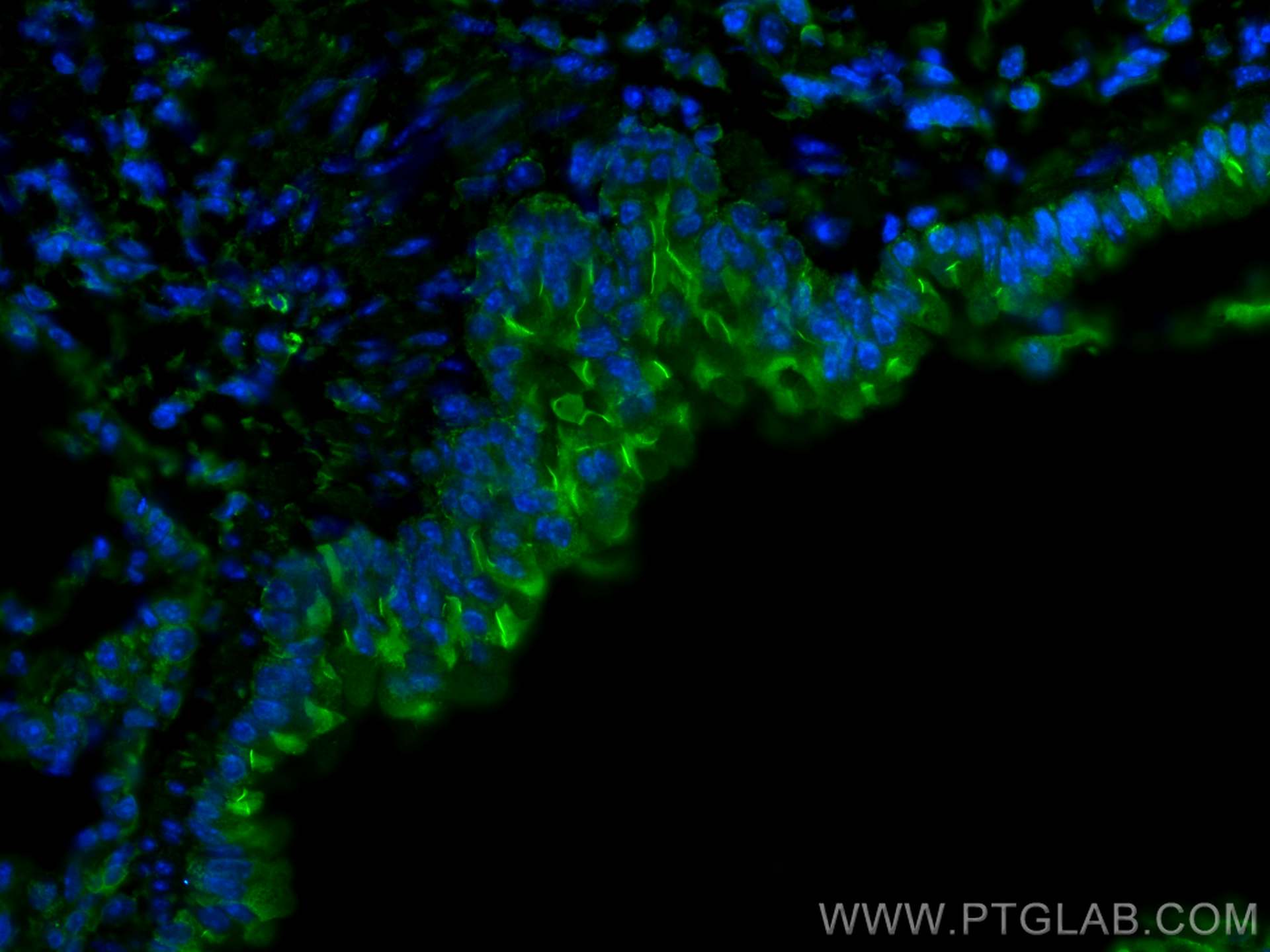 IF Staining of mouse lung using 26413-1-AP