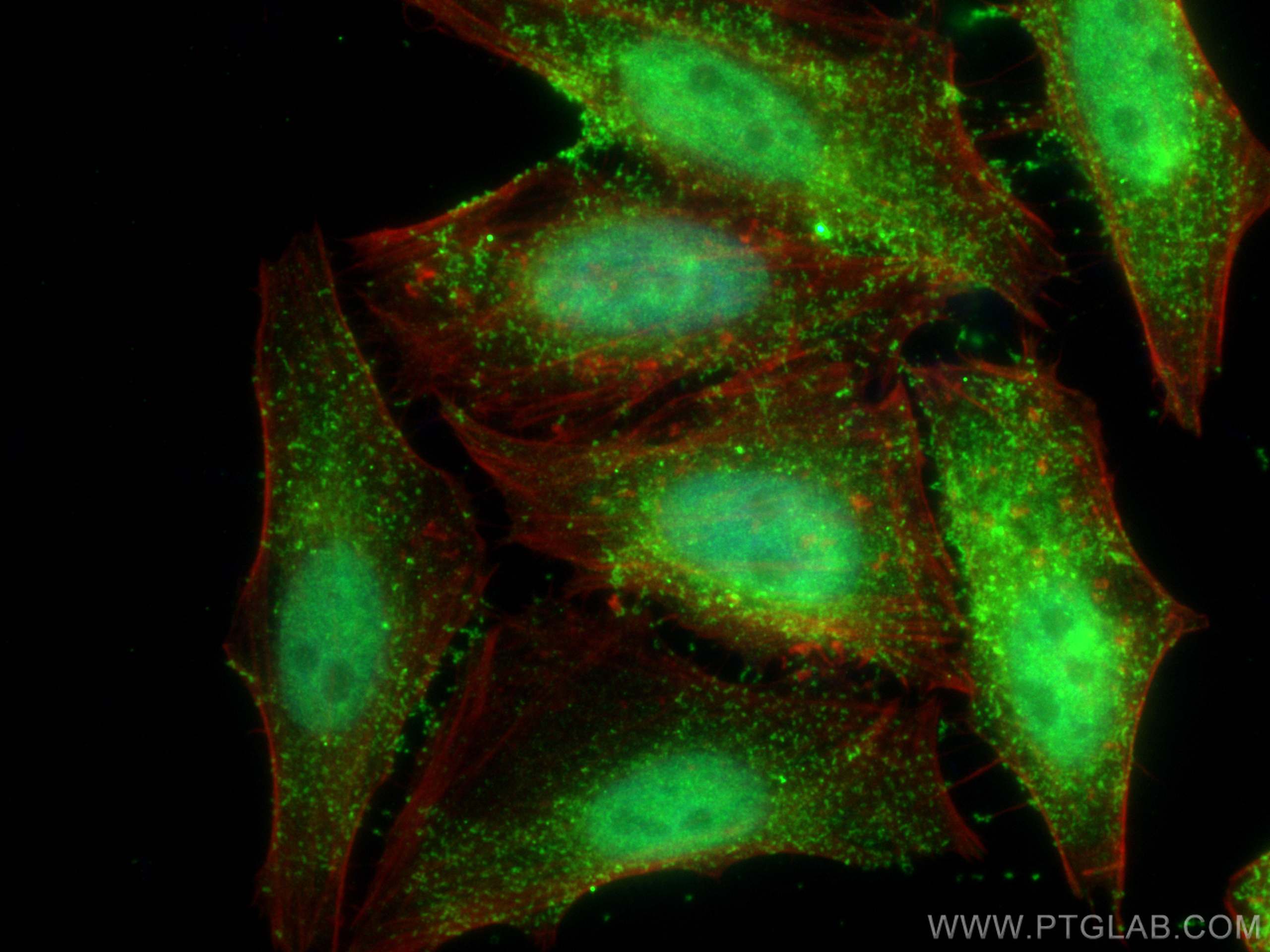 IF Staining of HepG2 using 22251-1-AP