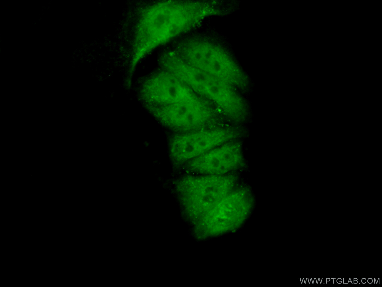 IF Staining of HepG2 using 22251-1-AP