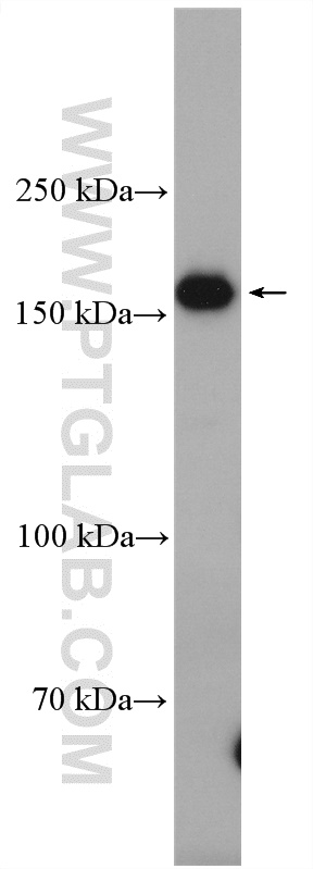 WB analysis of HeLa using 19542-1-AP