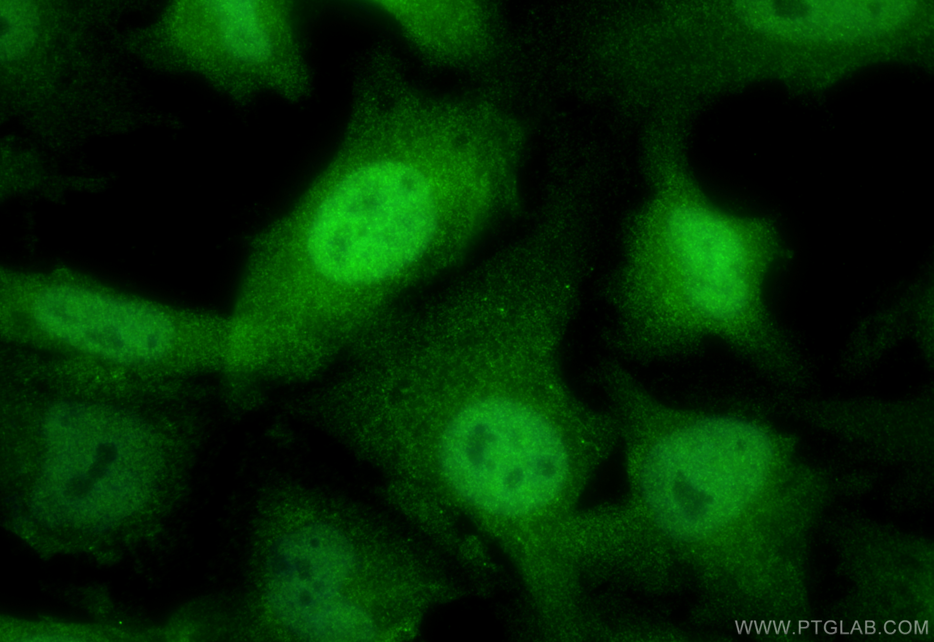 IF Staining of HeLa using 10215-1-AP