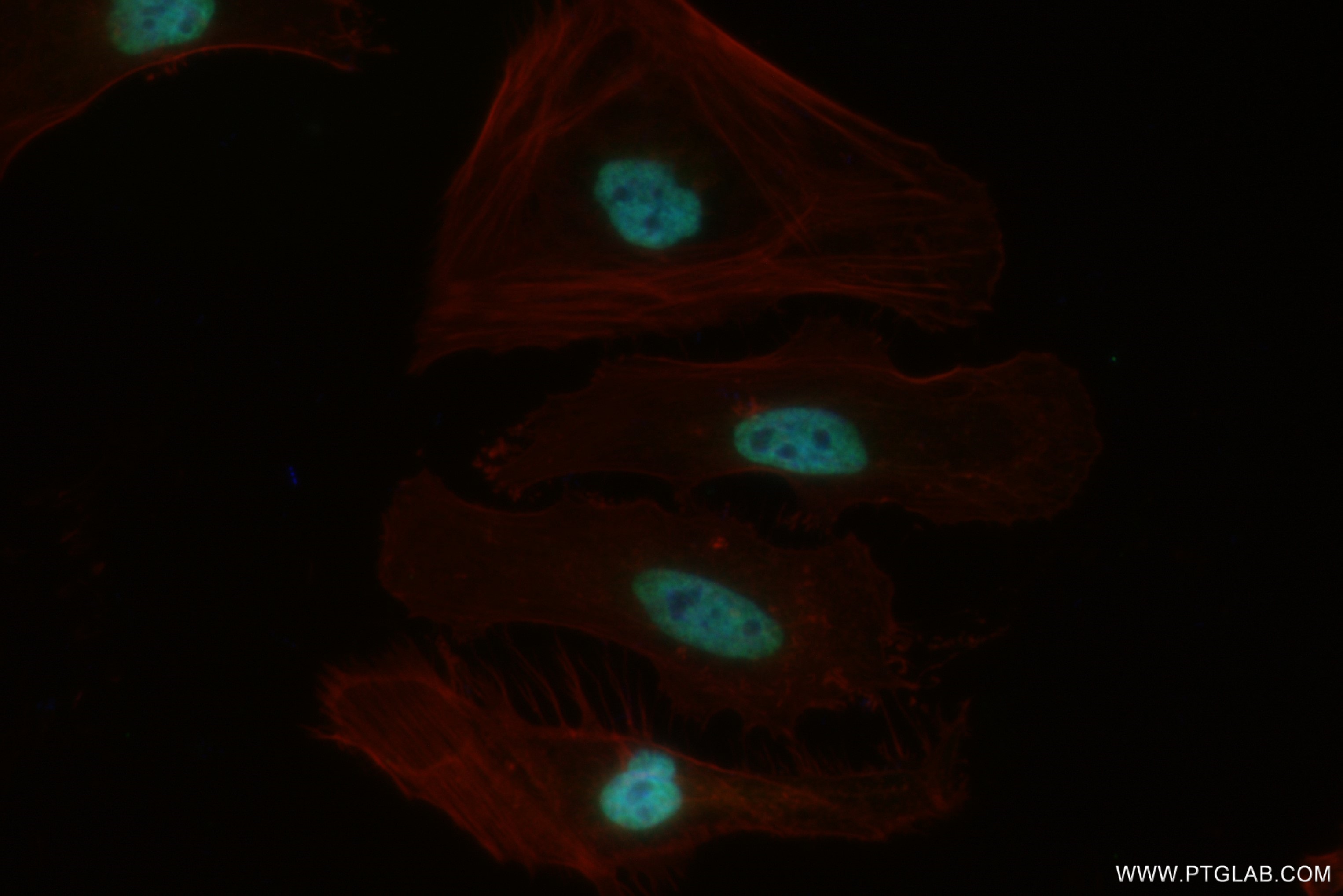IF Staining of HeLa using 82897-2-RR (same clone as 82897-2-PBS)