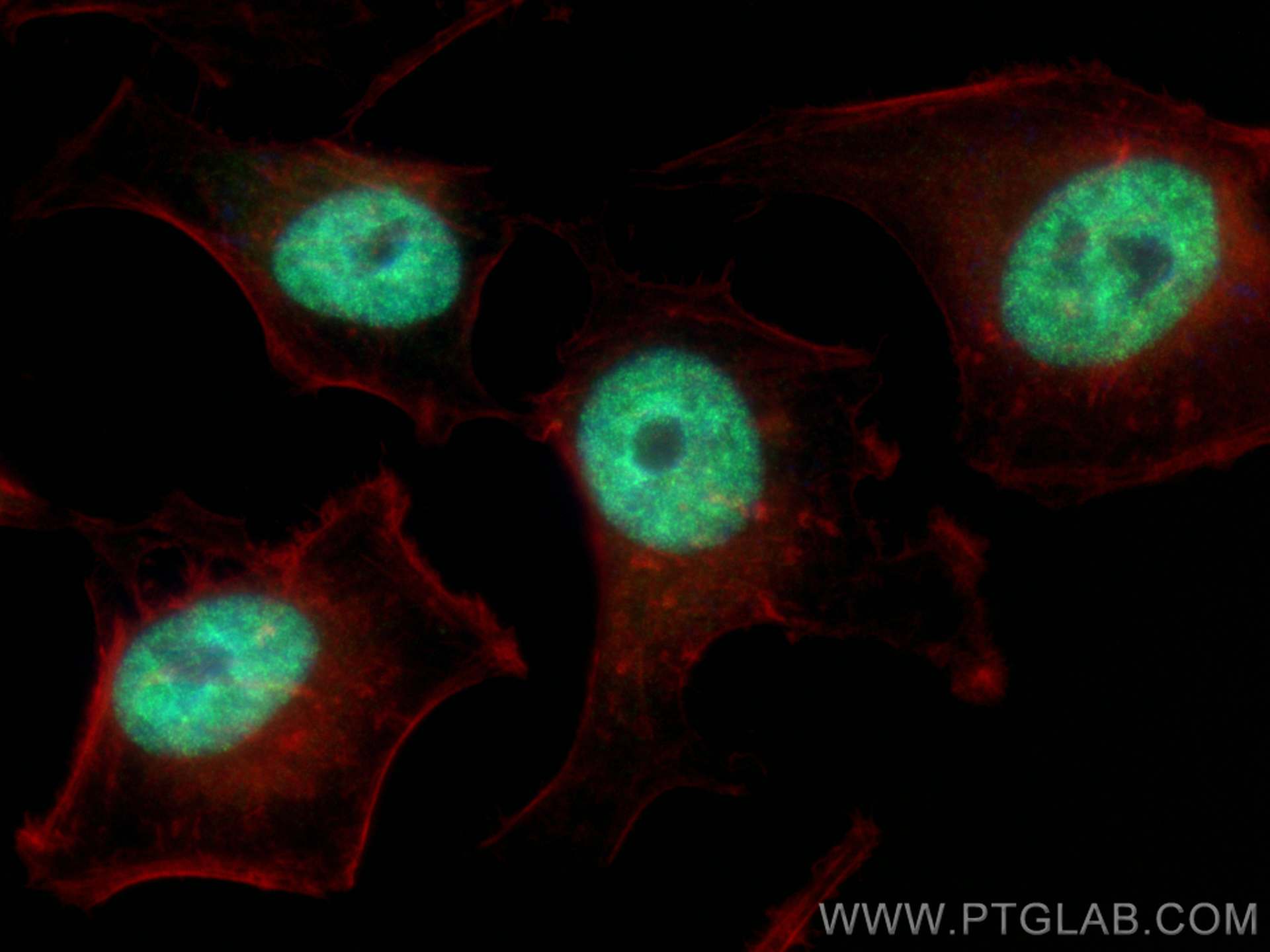 IF Staining of HeLa using 82897-2-RR (same clone as 82897-2-PBS)