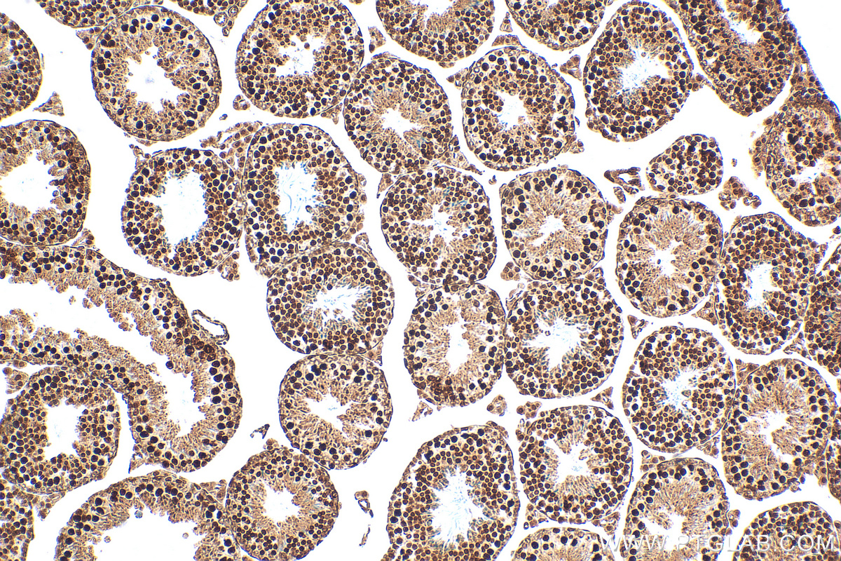 IHC staining of mouse testis using 82897-2-RR (same clone as 82897-2-PBS)