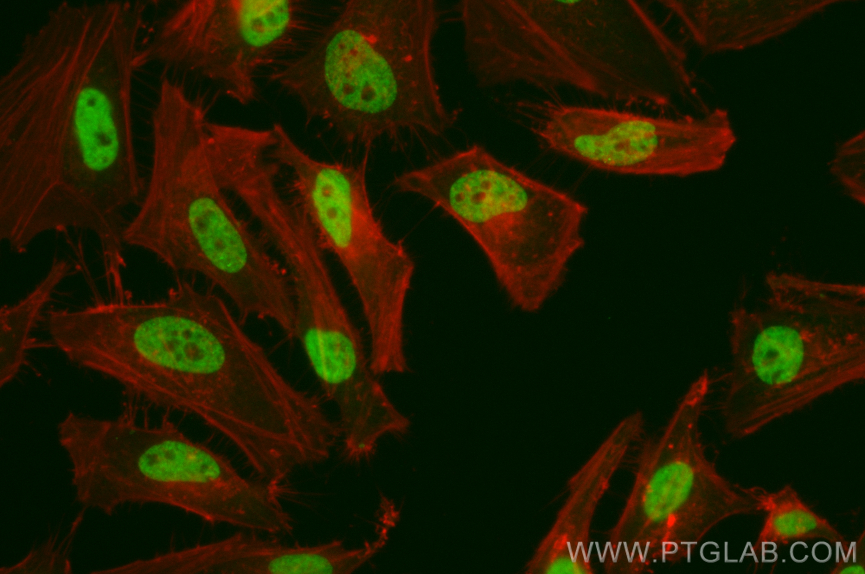 IF Staining of Hela using CL488-82897-2