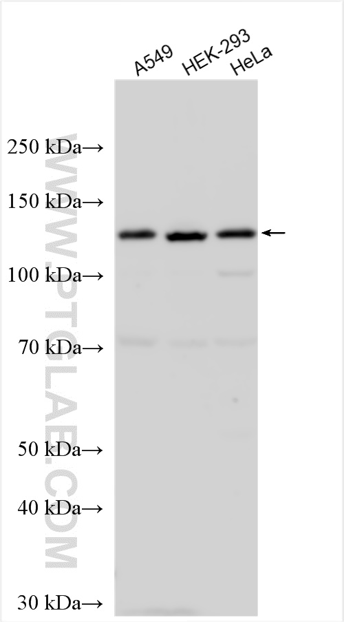 WB analysis using 24014-1-AP