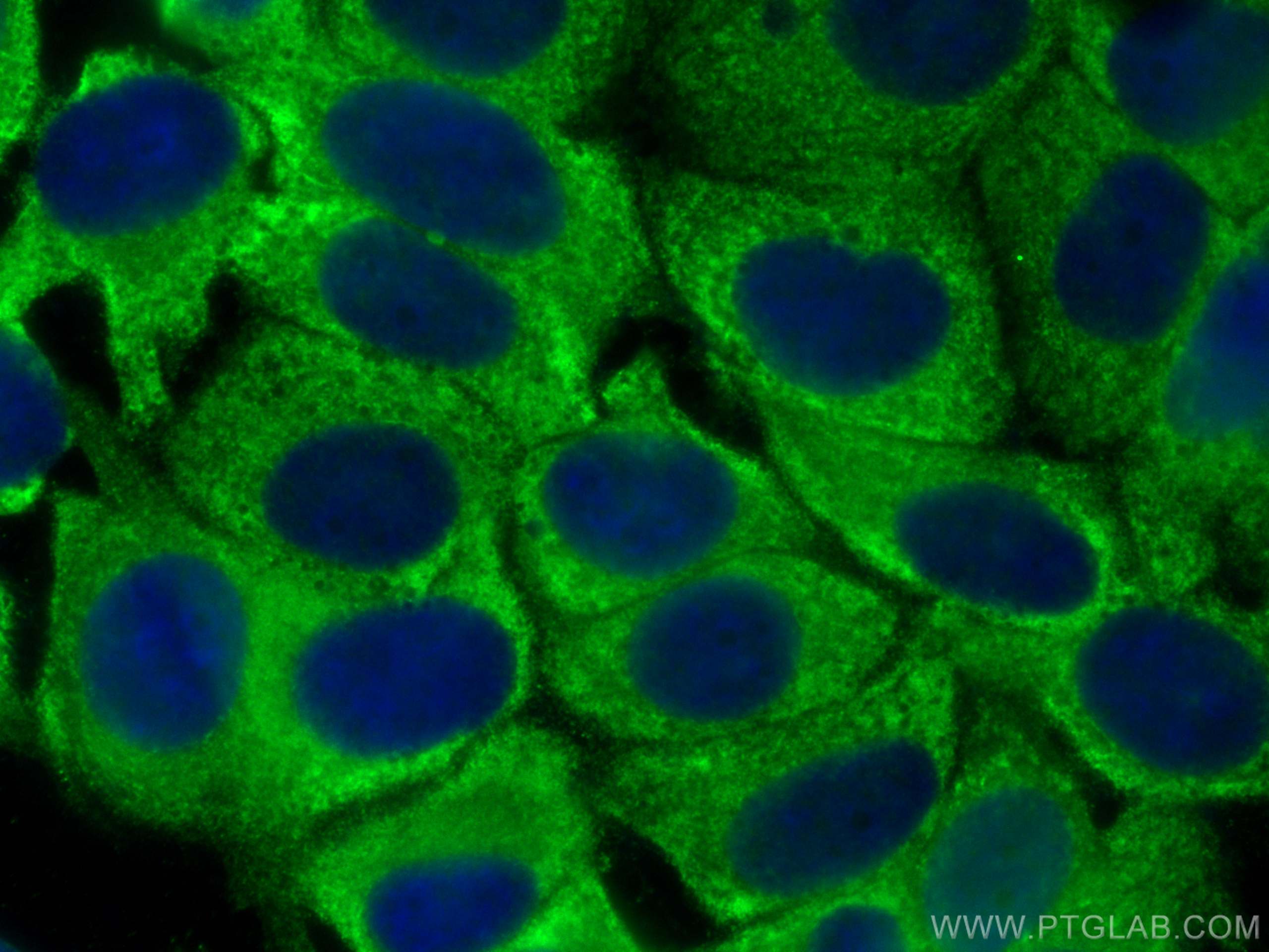 IF Staining of MCF-7 using 18121-1-AP