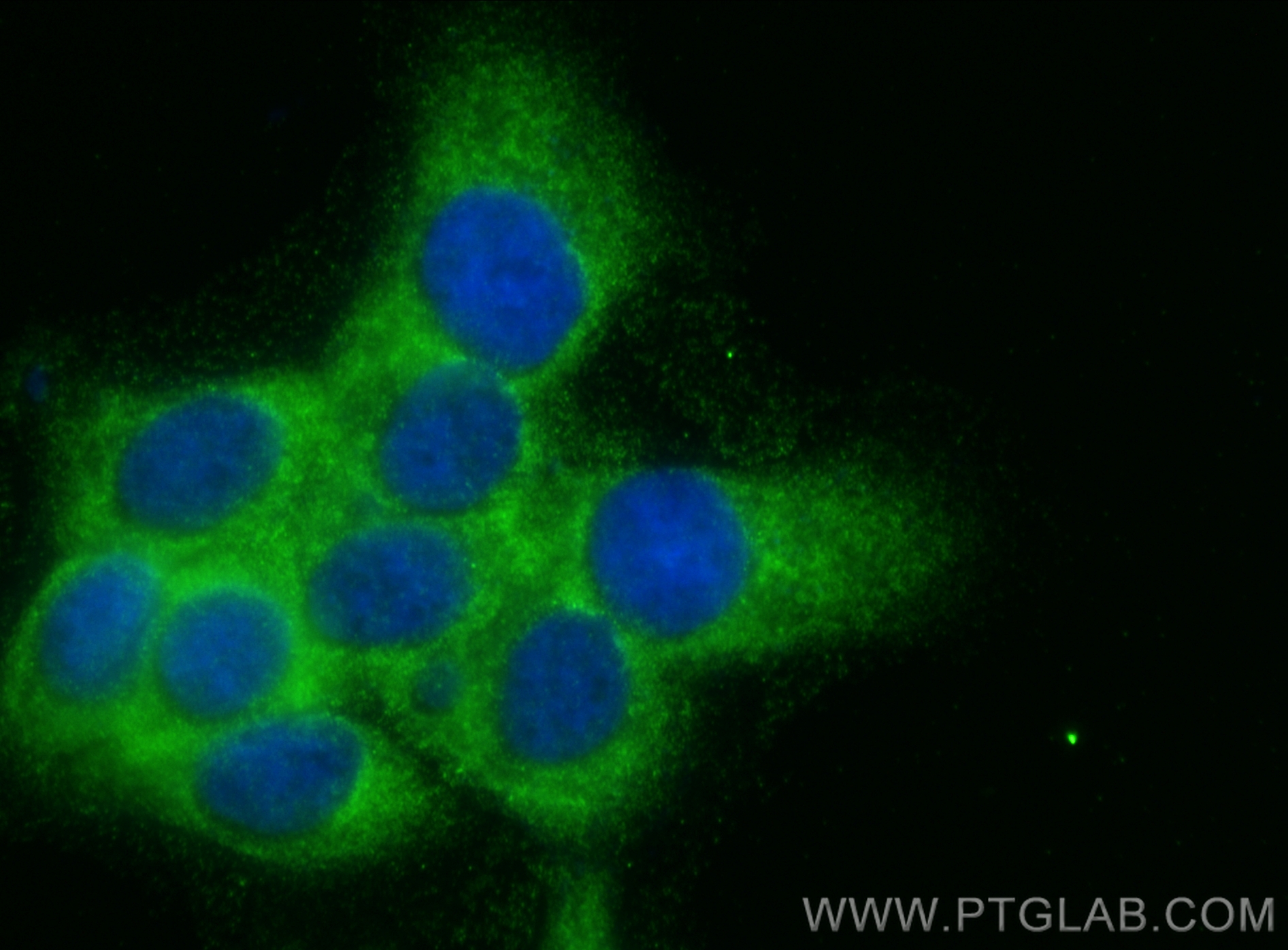 IF Staining of A431 using 67945-1-Ig