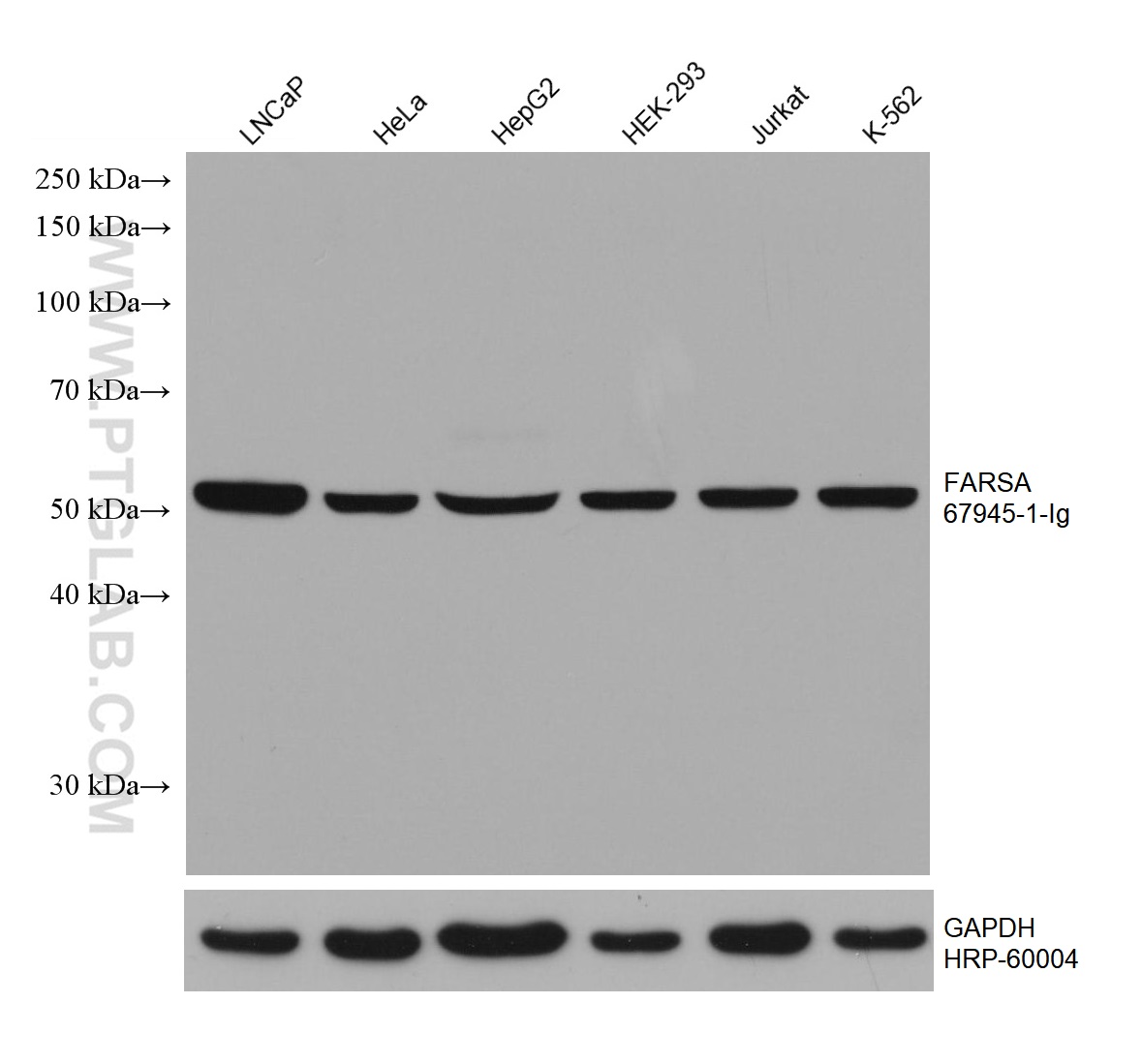 WB analysis using 67945-1-Ig