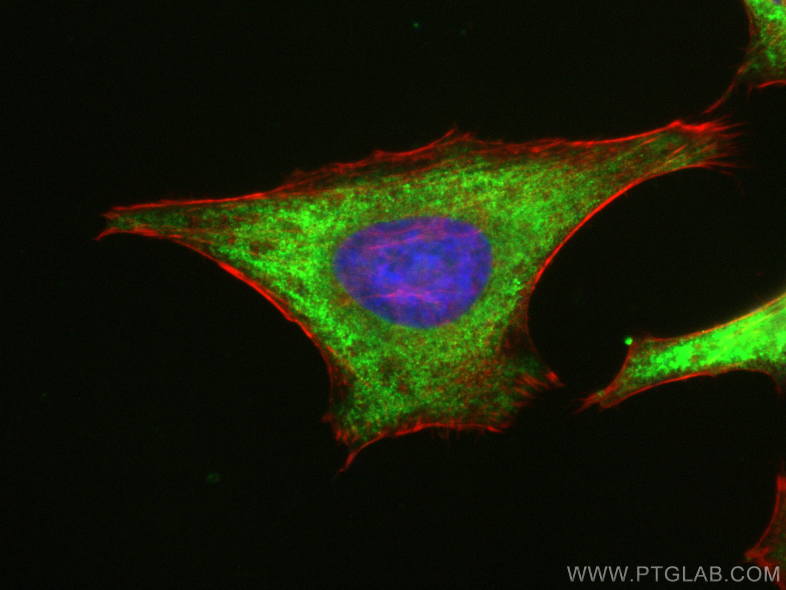 IF Staining of HeLa using CL488-18121