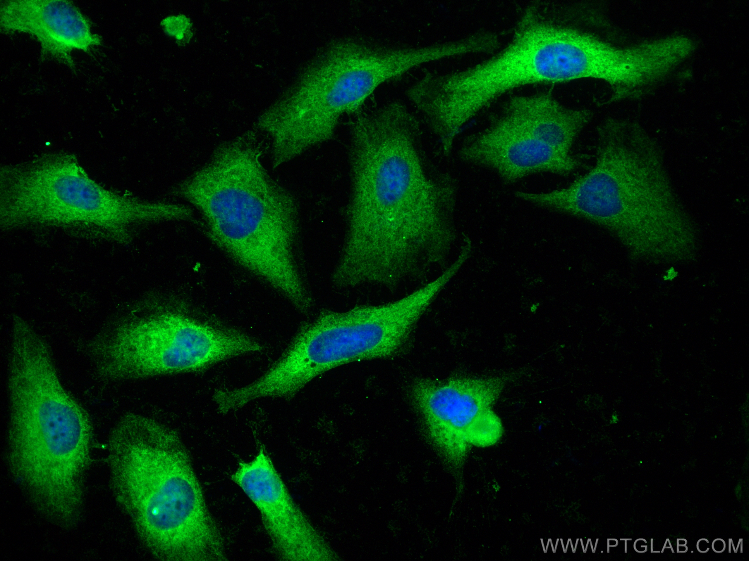 IF Staining of HeLa using 10624-2-AP