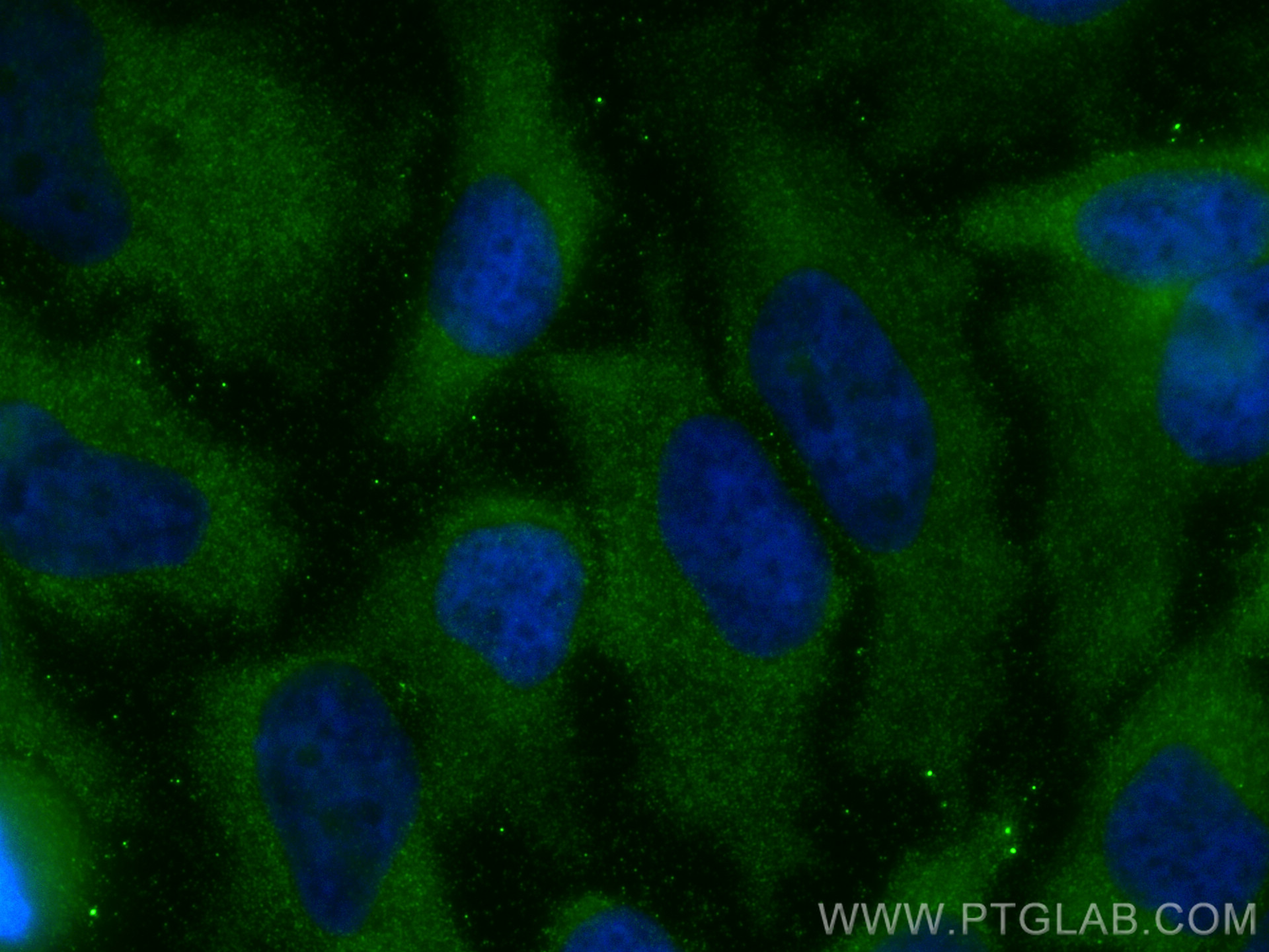 IF Staining of HeLa using 81079-1-RR (same clone as 81079-1-PBS)