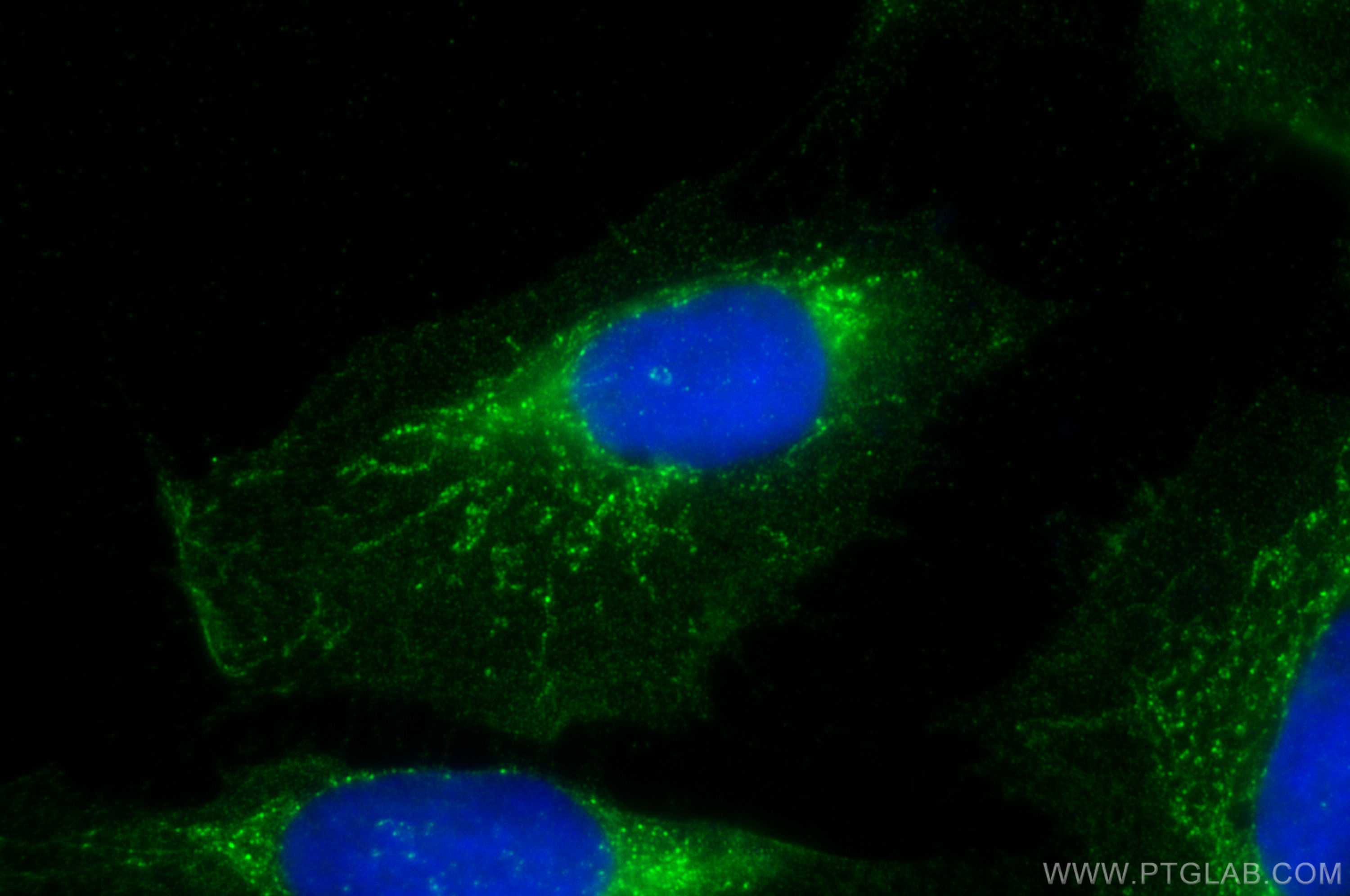 IF Staining of U2OS using 17464-1-AP