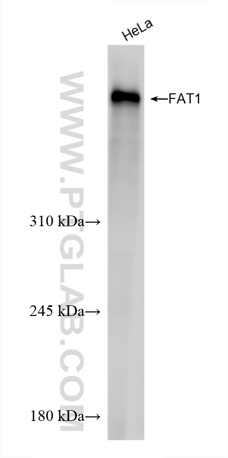 WB analysis of HeLa using 84279-3-RR